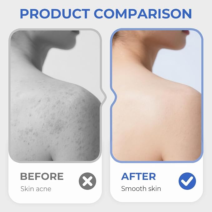 Silicone Shower Foot Scrubber Mat,2025 New Back Exfoliating Bath Wash Pad Wall Mounted Anti-Slip Suction Cups Foot Scrubber,Deep Cleaning Brush Back Massager Pad for Women Men (A-Blue)