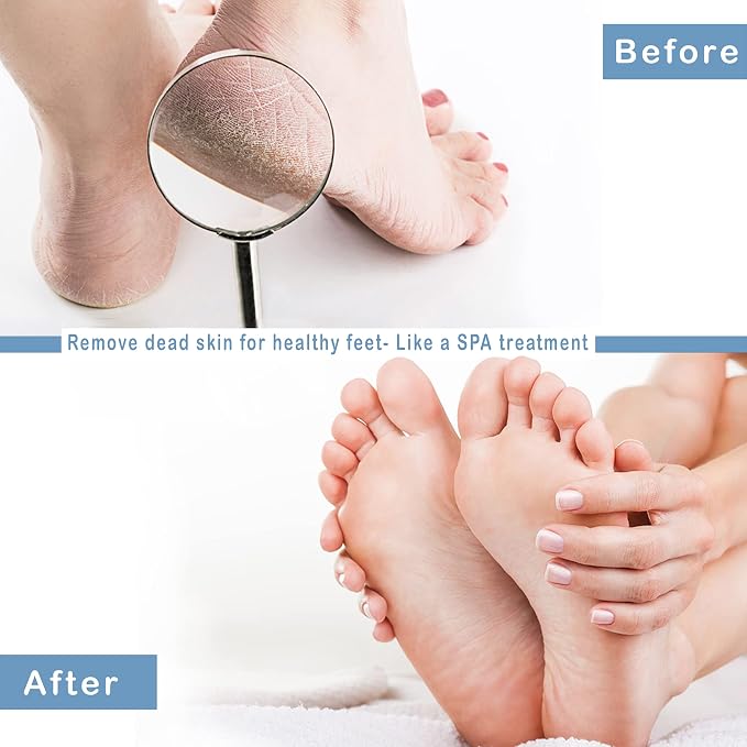 1 Pcs Convenient in Shower Foot Scrubber Wall-Mounted Silicone Foot Scrubber Shower with Suction Cups, Foot Scrubbers for Use in Shower, Only Stick on Glass Surfaces, Foot Scrubber Mat 1 Hook Included