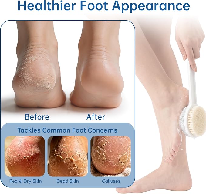 Foot Scrubber with Pumice Stone & 2 Pcs Toe Cleaning Brush, Long Handle Callus Remover for Feet, Toe Cleaning Brush for Dead Skin, Shower Foot Brush for Seniors, Elderly, Men Women (Include 4 Hooks)